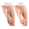 Rechargeable Electric Callus Remover