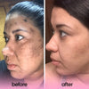 Kojic Acid Turmeric Cleansing Pads