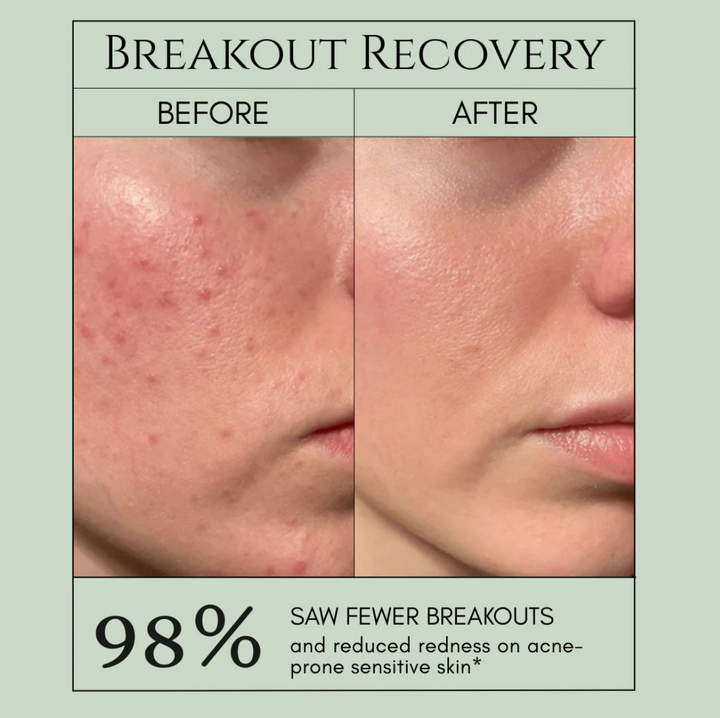 Holy Basil Bubble Deep Mask